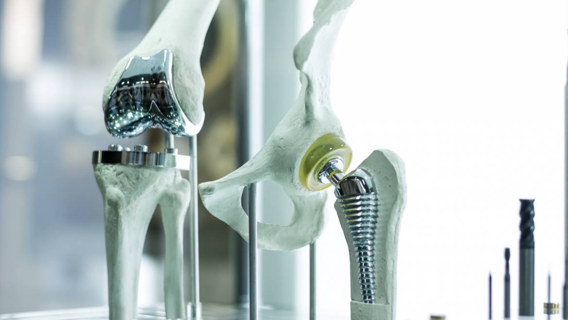 Chirurgia Protesica Robotizzata e Fast Track